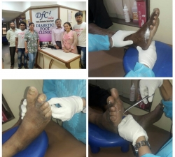 Diabetic Foot Clinic